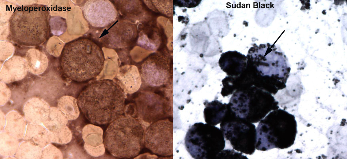 Image 4: Cytochemical stains, myeloperoxidase and Sudan black